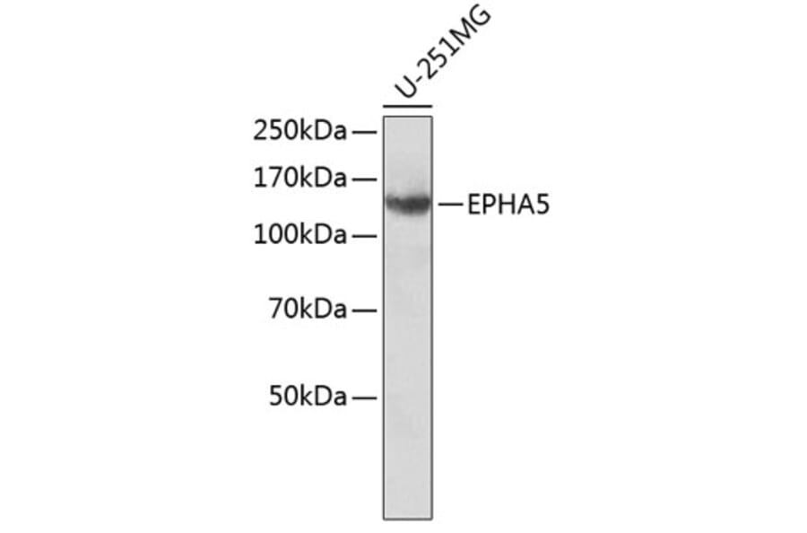 Western Blot - Anti-EPHA5 Antibody (A8036) - Antibodies.com