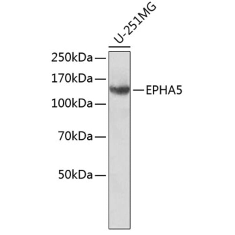 Western Blot - Anti-EPHA5 Antibody (A8036) - Antibodies.com
