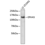 Western Blot - Anti-EPHA5 Antibody (A8036) - Antibodies.com