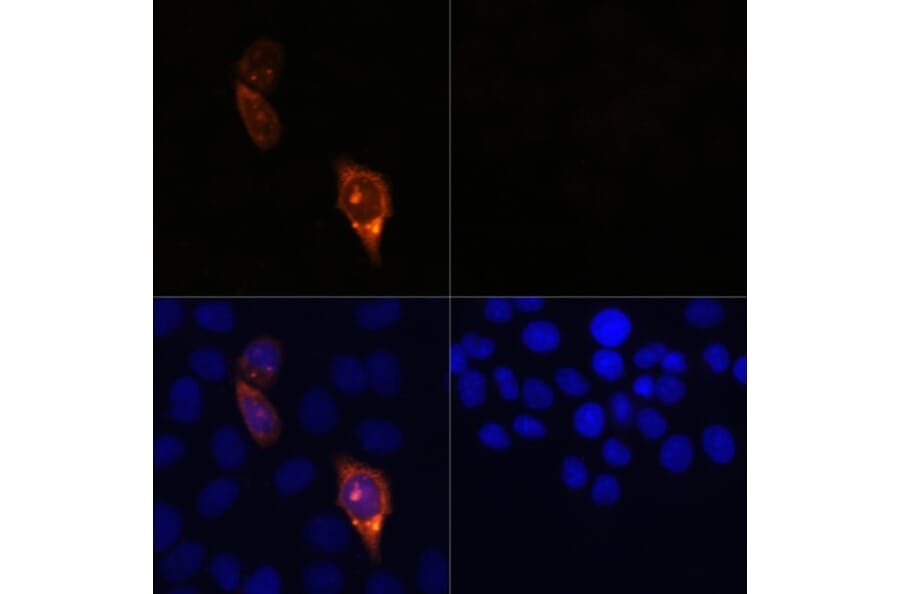Immunofluorescence - Anti-CRISPR-Cas9 Antibody (A92824) - Antibodies.com