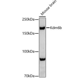 Western Blot - Anti-KDM6B / JMJD3 Antibody (A92825) - Antibodies.com