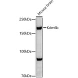 Western Blot - Anti-KDM6B/JMJD3 Antibody (A92825) - Antibodies.com