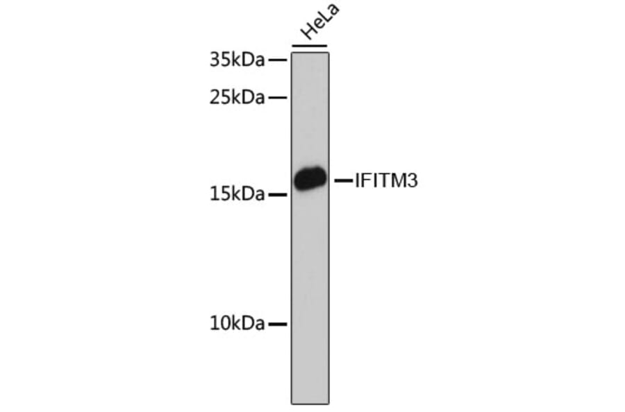 Western Blot - Anti-Fragilis Antibody (A92826) - Antibodies.com