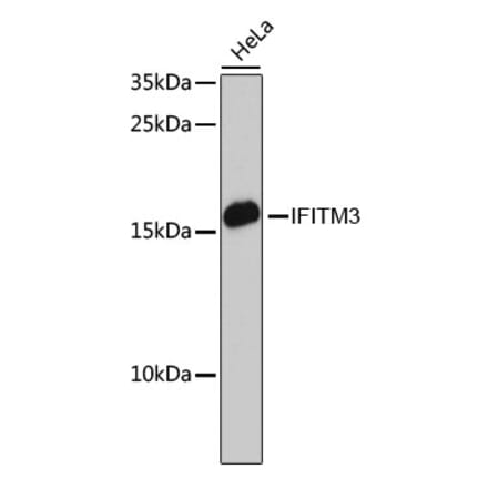 Western Blot - Anti-Fragilis Antibody (A92826) - Antibodies.com