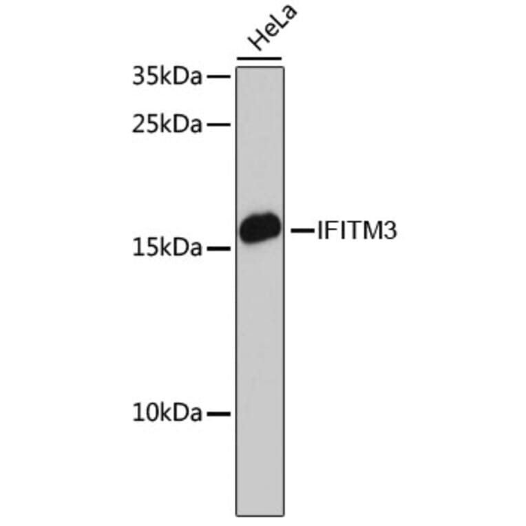 Western Blot - Anti-Fragilis Antibody (A92826) - Antibodies.com