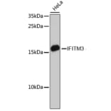 Western Blot - Anti-Fragilis Antibody (A92826) - Antibodies.com