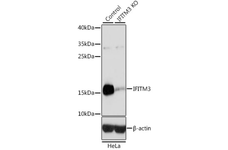Western Blot - Anti-Fragilis Antibody (A92826) - Antibodies.com