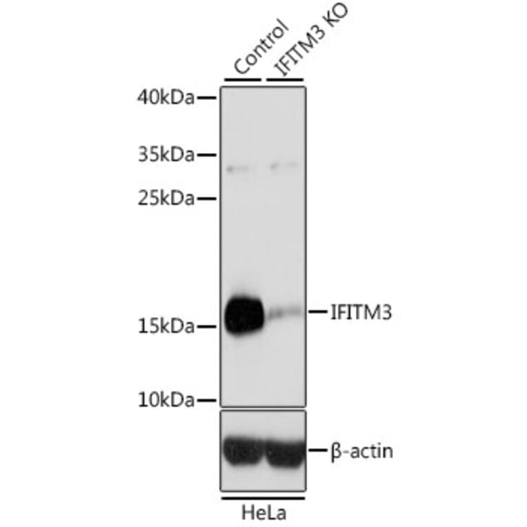 Western Blot - Anti-Fragilis Antibody (A92826) - Antibodies.com