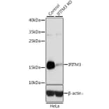 Western Blot - Anti-Fragilis Antibody (A92826) - Antibodies.com