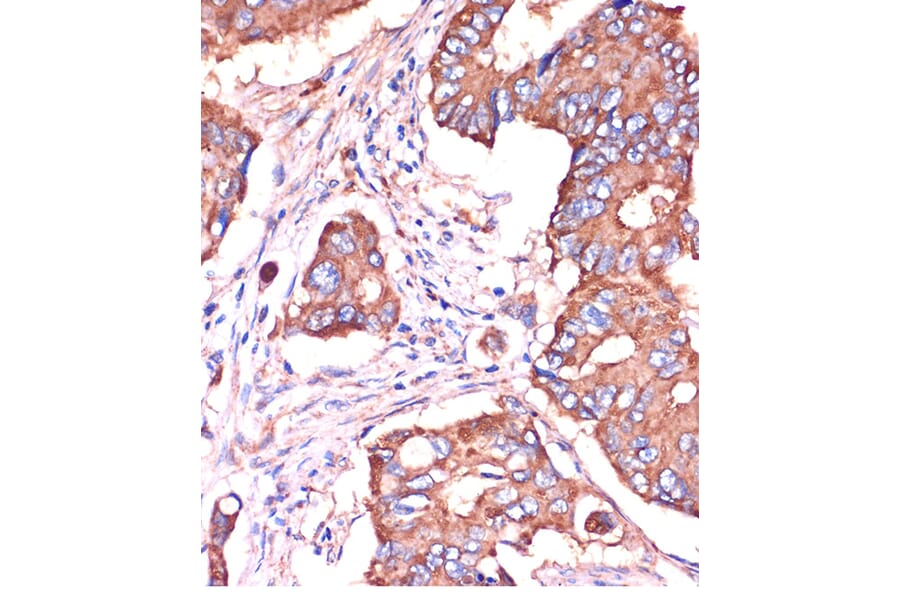 Immunohistochemistry - Anti-Fragilis Antibody (A92826) - Antibodies.com