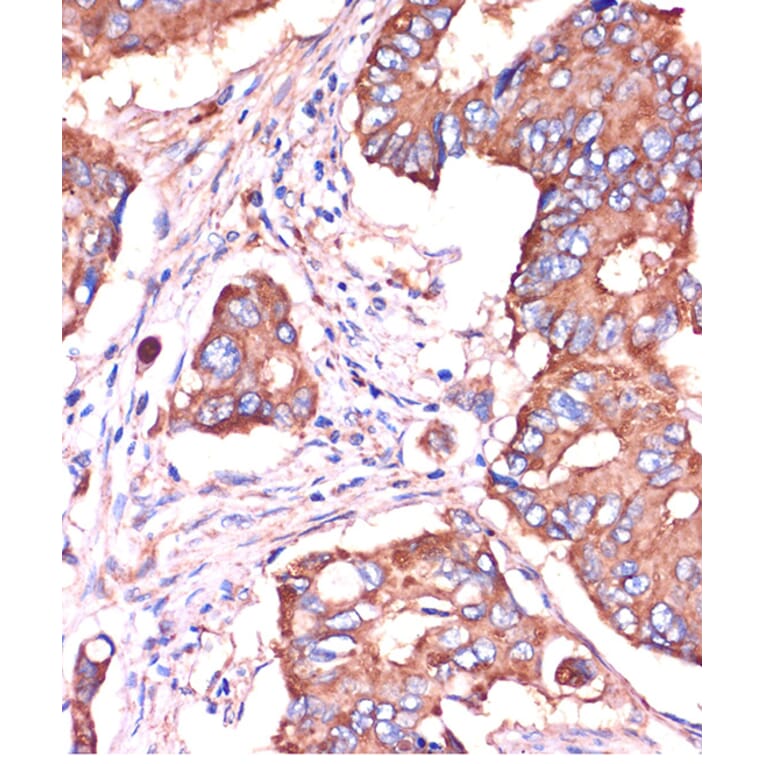 Immunohistochemistry - Anti-Fragilis Antibody (A92826) - Antibodies.com