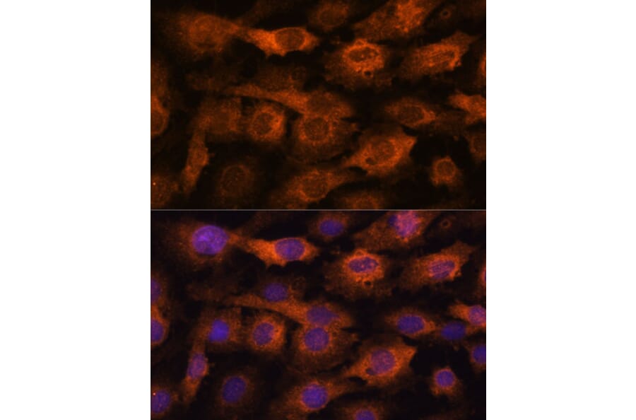 Immunofluorescence - Anti-Fragilis Antibody (A92826) - Antibodies.com