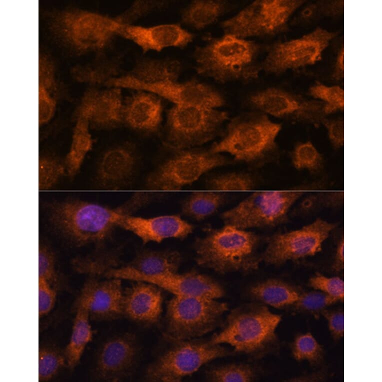 Immunofluorescence - Anti-Fragilis Antibody (A92826) - Antibodies.com