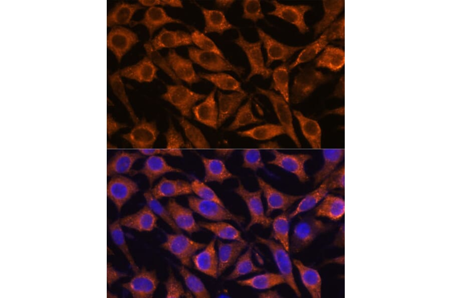 Immunofluorescence - Anti-Fragilis Antibody (A92826) - Antibodies.com