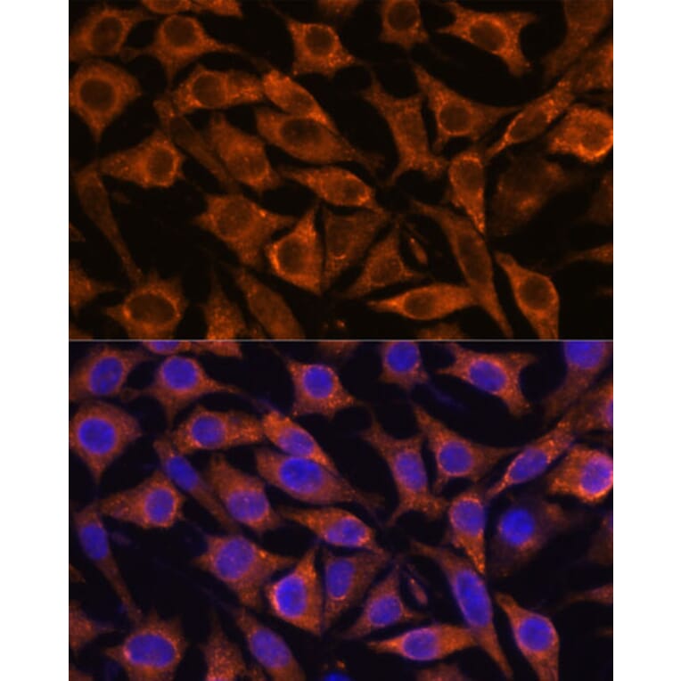 Immunofluorescence - Anti-Fragilis Antibody (A92826) - Antibodies.com