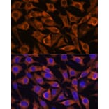 Immunofluorescence - Anti-Fragilis Antibody (A92826) - Antibodies.com