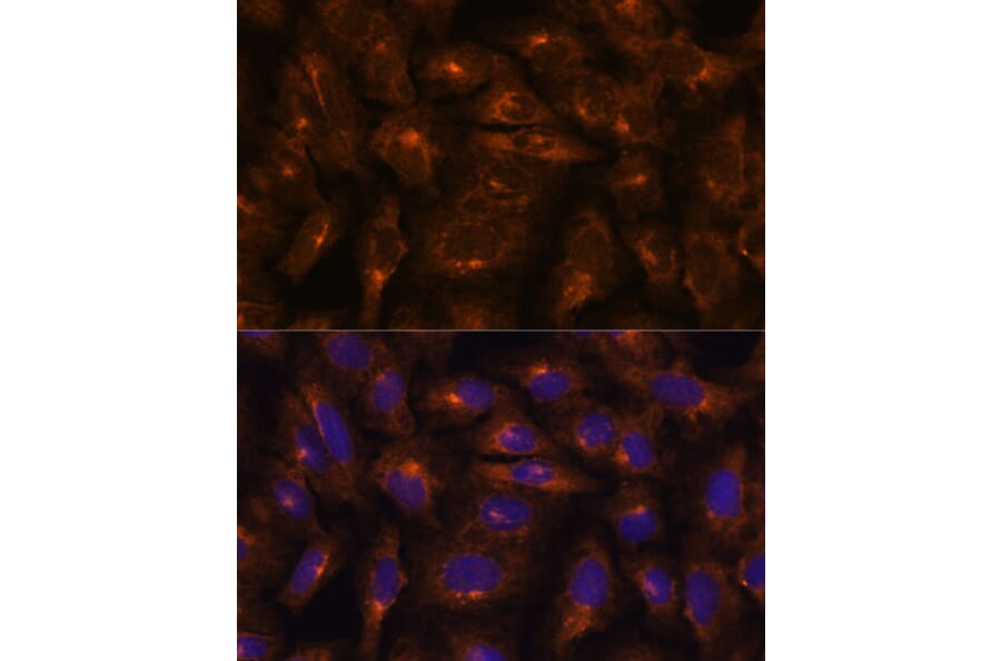 Immunofluorescence - Anti-Fragilis Antibody (A92826) - Antibodies.com