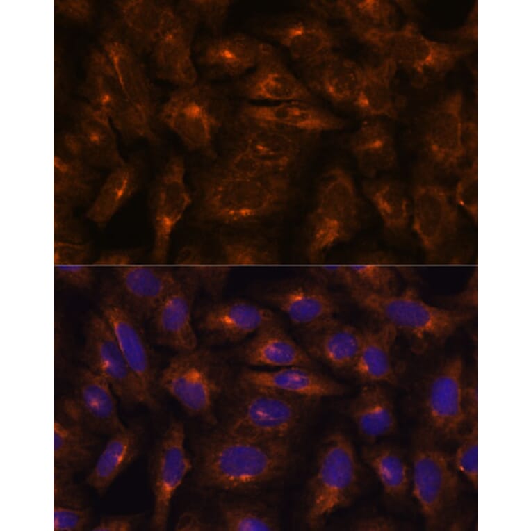 Immunofluorescence - Anti-Fragilis Antibody (A92826) - Antibodies.com