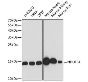 Western Blot - Anti-NDUFB4 Antibody (A92828) - Antibodies.com