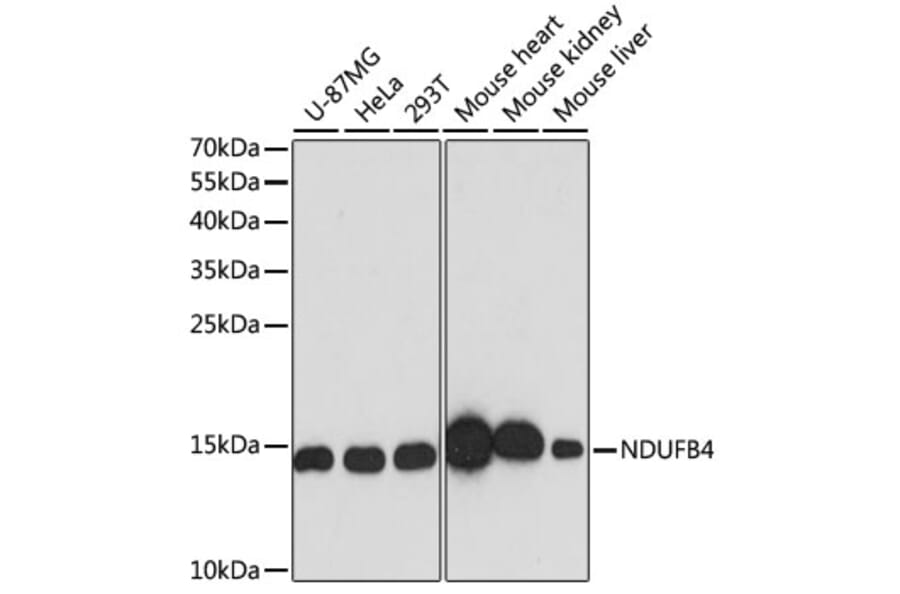 Western Blot - Anti-NDUFB4 Antibody (A92828) - Antibodies.com