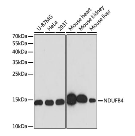 Western Blot - Anti-NDUFB4 Antibody (A92828) - Antibodies.com