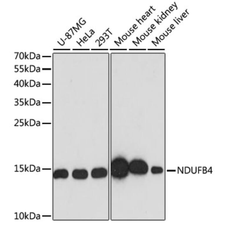 Western Blot - Anti-NDUFB4 Antibody (A92828) - Antibodies.com