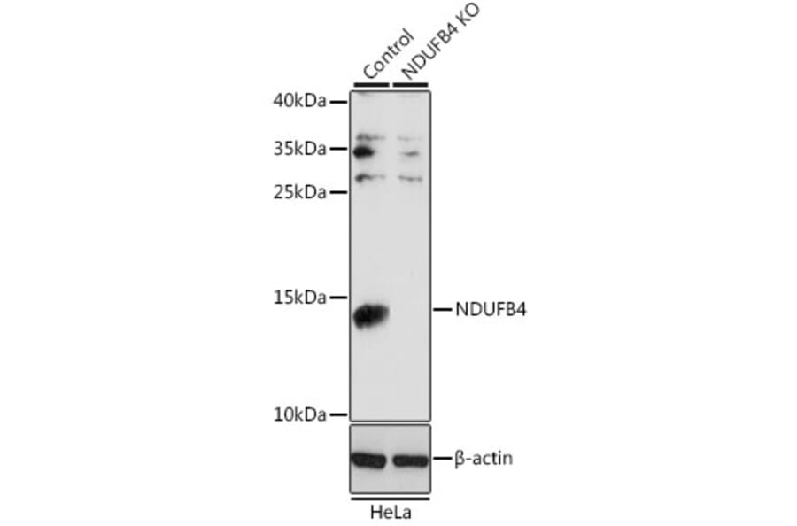 Western Blot - Anti-NDUFB4 Antibody (A92828) - Antibodies.com