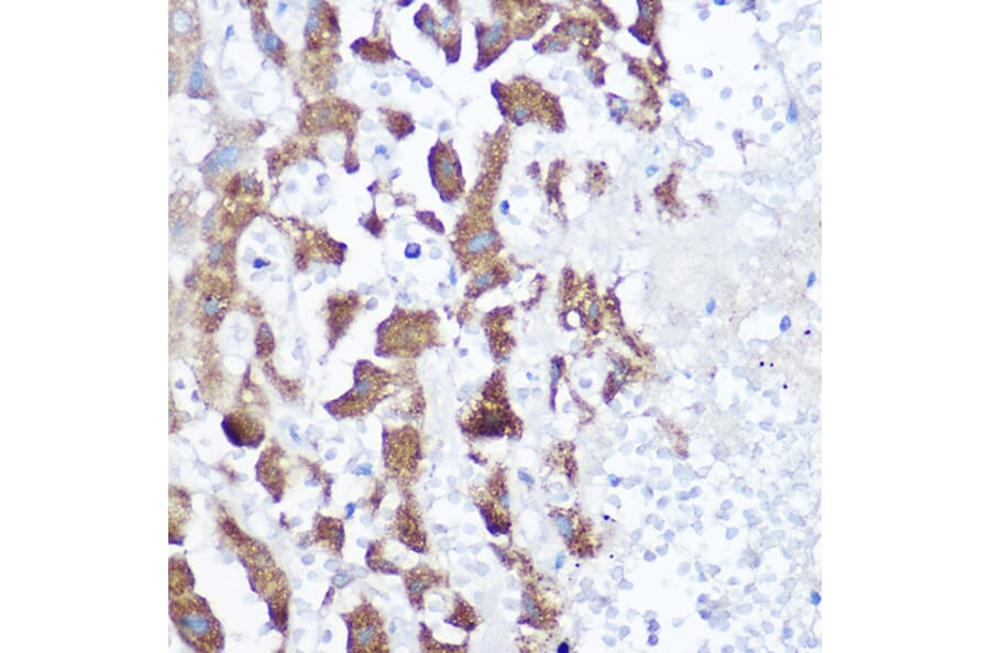 Immunohistochemistry - Anti-NDUFB4 Antibody (A92828) - Antibodies.com