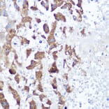 Immunohistochemistry - Anti-NDUFB4 Antibody (A92828) - Antibodies.com