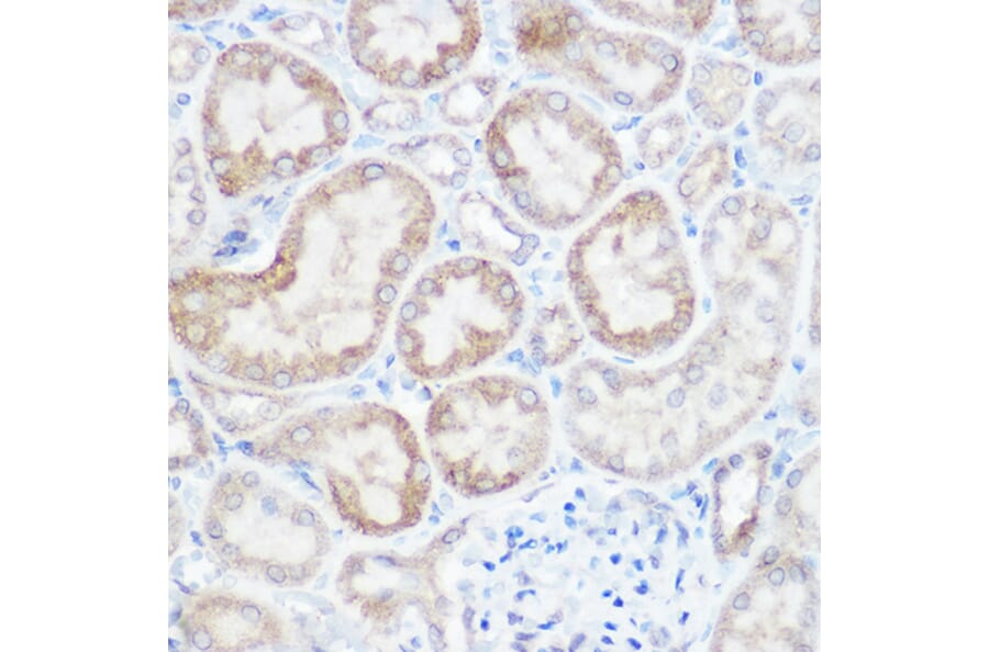 Immunohistochemistry - Anti-NDUFB4 Antibody (A92828) - Antibodies.com
