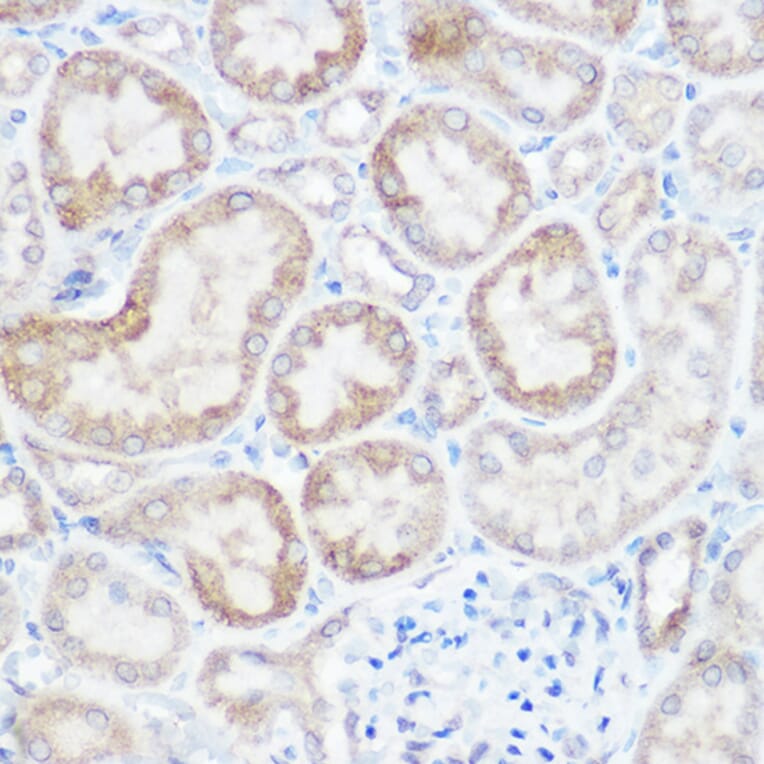 Immunohistochemistry - Anti-NDUFB4 Antibody (A92828) - Antibodies.com