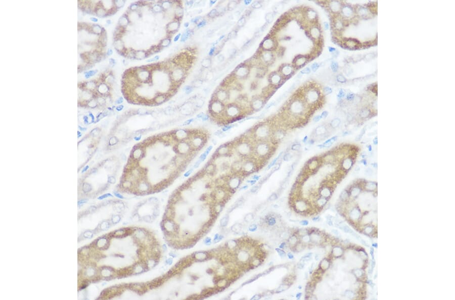 Immunohistochemistry - Anti-NDUFB4 Antibody (A92828) - Antibodies.com