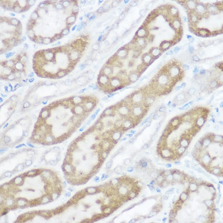 Immunohistochemistry - Anti-NDUFB4 Antibody (A92828) - Antibodies.com