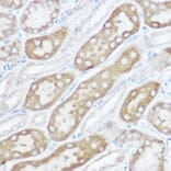 Immunohistochemistry - Anti-NDUFB4 Antibody (A92828) - Antibodies.com