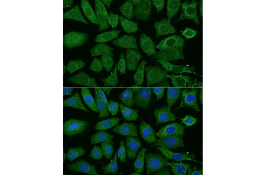 Immunofluorescence - Anti-NDUFB4 Antibody (A92828) - Antibodies.com