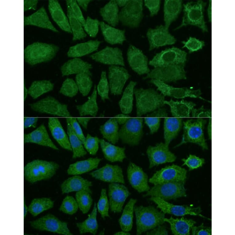 Immunofluorescence - Anti-NDUFB4 Antibody (A92828) - Antibodies.com