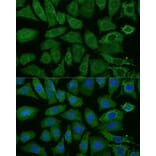 Immunofluorescence - Anti-NDUFB4 Antibody (A92828) - Antibodies.com