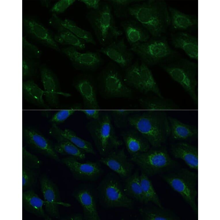 Immunofluorescence - Anti-NDUFB4 Antibody (A92828) - Antibodies.com