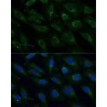 Immunofluorescence - Anti-NDUFB4 Antibody (A92828) - Antibodies.com