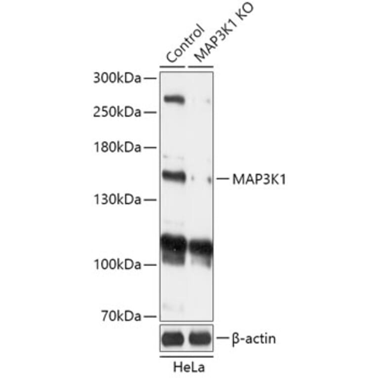 Western Blot - Anti-MAP3K1 Antibody (A92831) - Antibodies.com