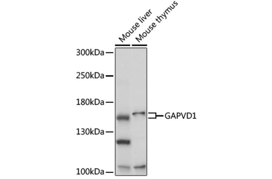 Western Blot - Anti-GAPex 5 Antibody (A92832) - Antibodies.com