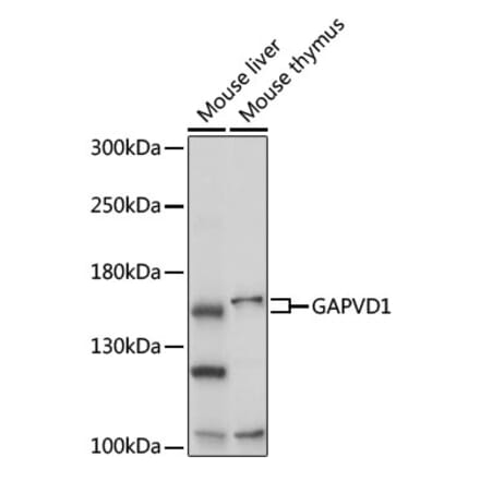 Western Blot - Anti-GAPex 5 Antibody (A92832) - Antibodies.com