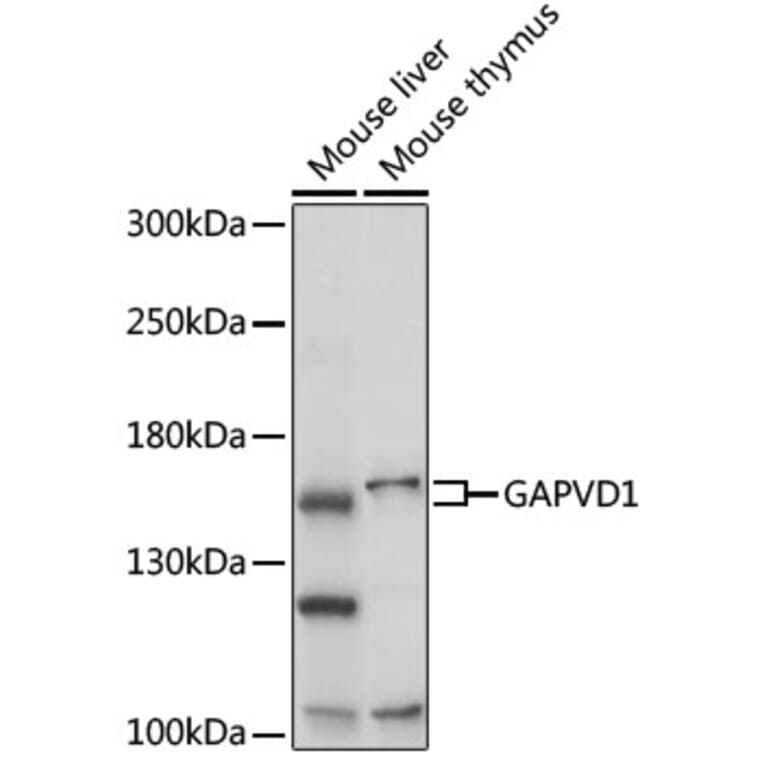Western Blot - Anti-GAPex 5 Antibody (A92832) - Antibodies.com