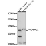 Western Blot - Anti-GAPex 5 Antibody (A92832) - Antibodies.com