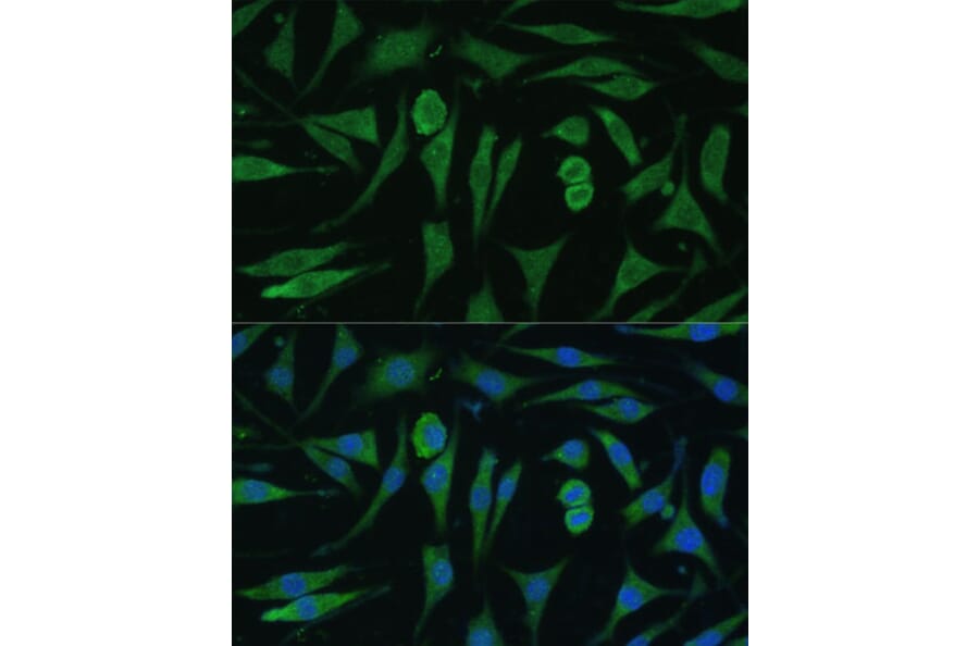 Immunofluorescence - Anti-GAPex 5 Antibody (A92832) - Antibodies.com