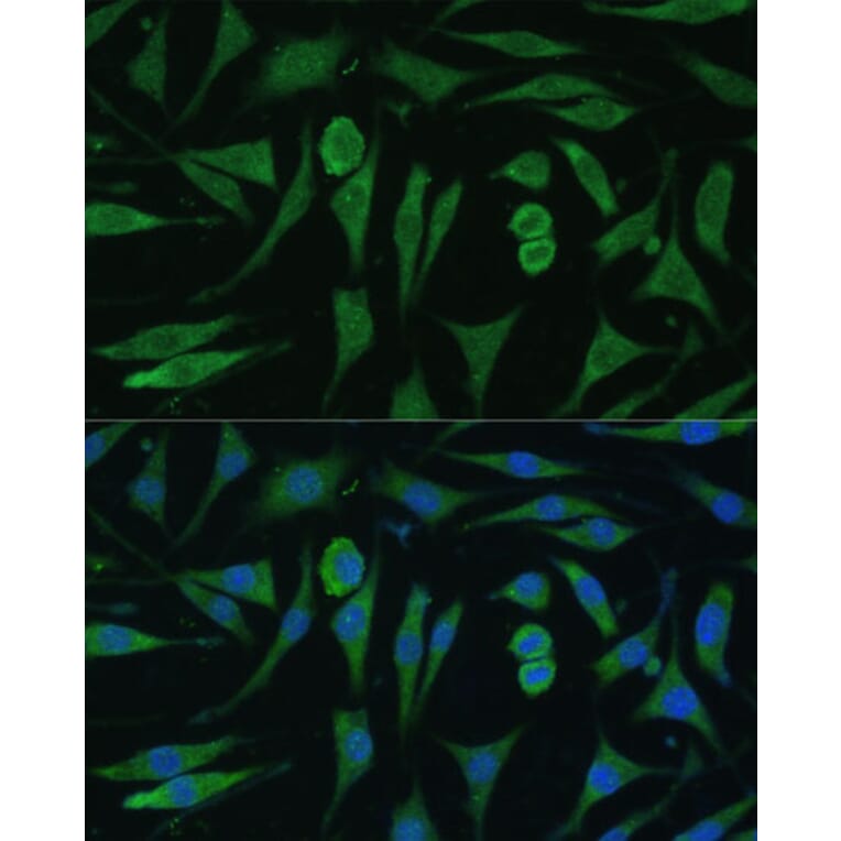 Immunofluorescence - Anti-GAPex 5 Antibody (A92832) - Antibodies.com