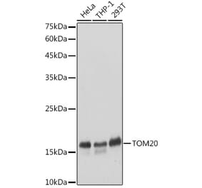 Western Blot - Anti-TOMM20 Antibody (A92833) - Antibodies.com