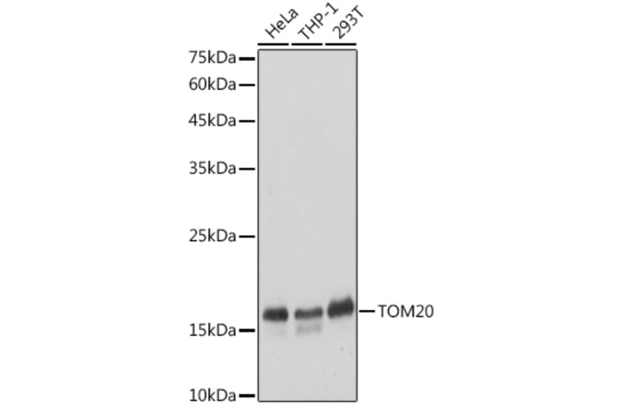 Western Blot - Anti-TOMM20 Antibody (A92833) - Antibodies.com