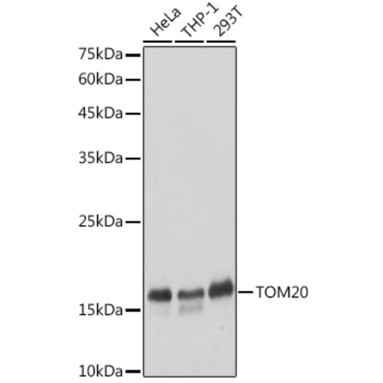 Western Blot - Anti-TOMM20 Antibody (A92833) - Antibodies.com