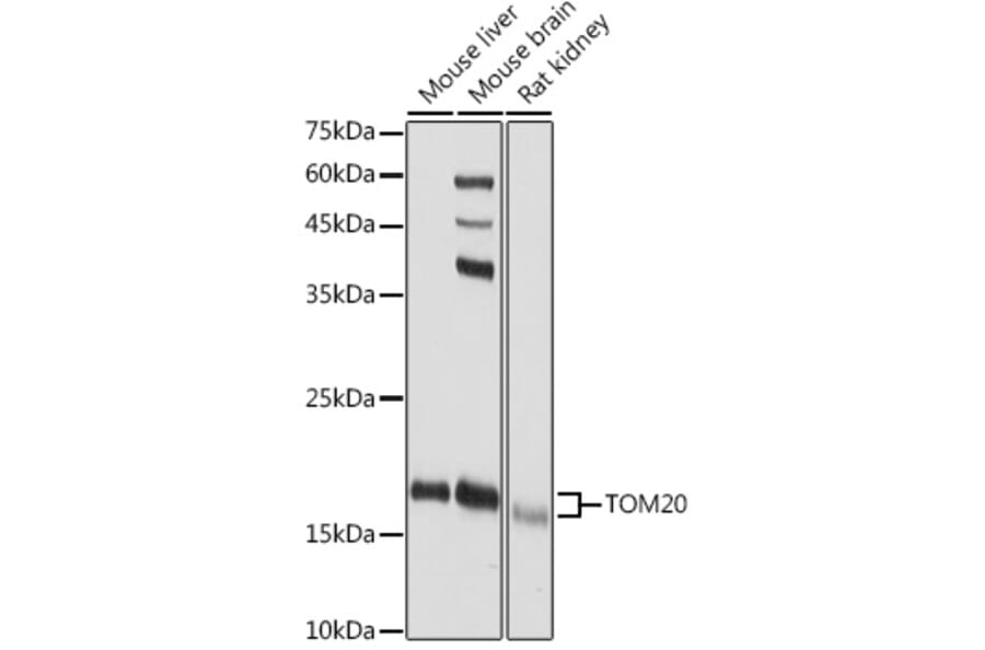 Western Blot - Anti-TOMM20 Antibody (A92833) - Antibodies.com